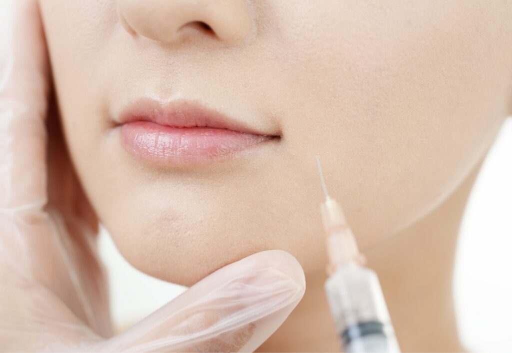 ボトックスとは