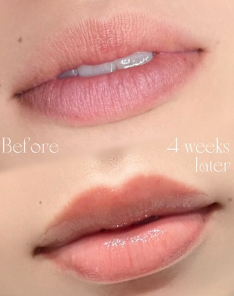 before After