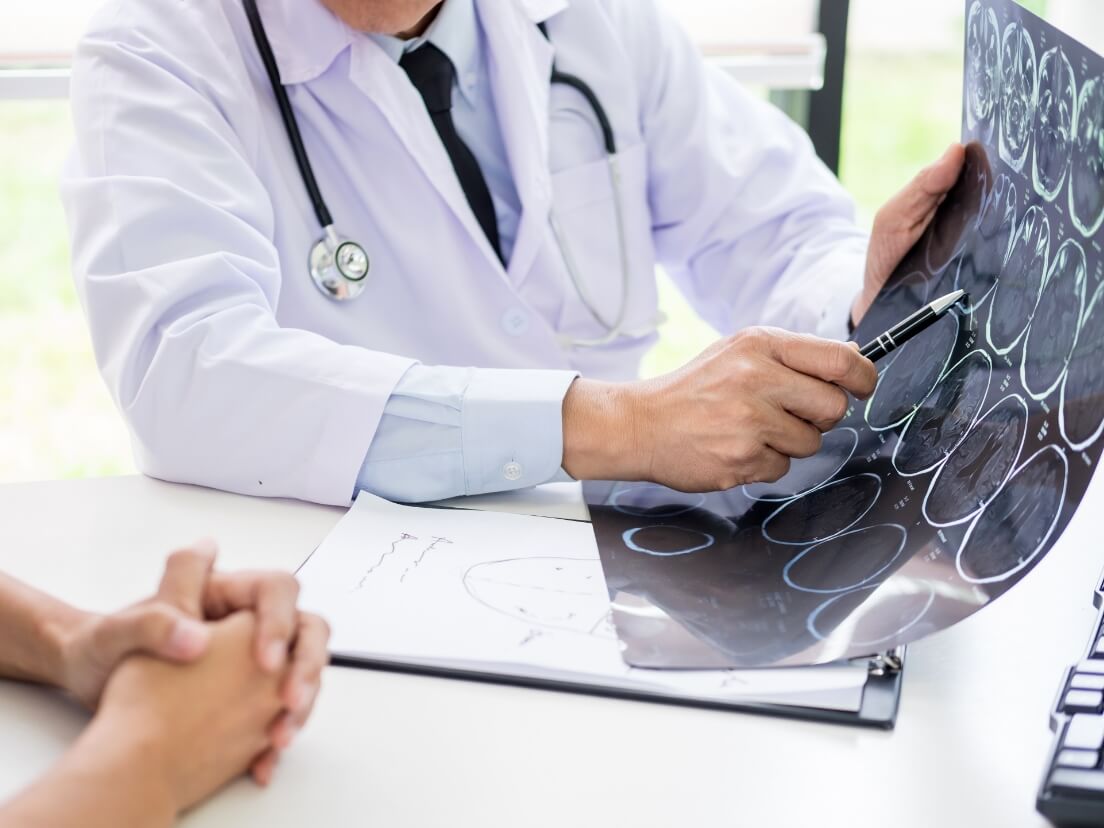 脳神経内科とは？